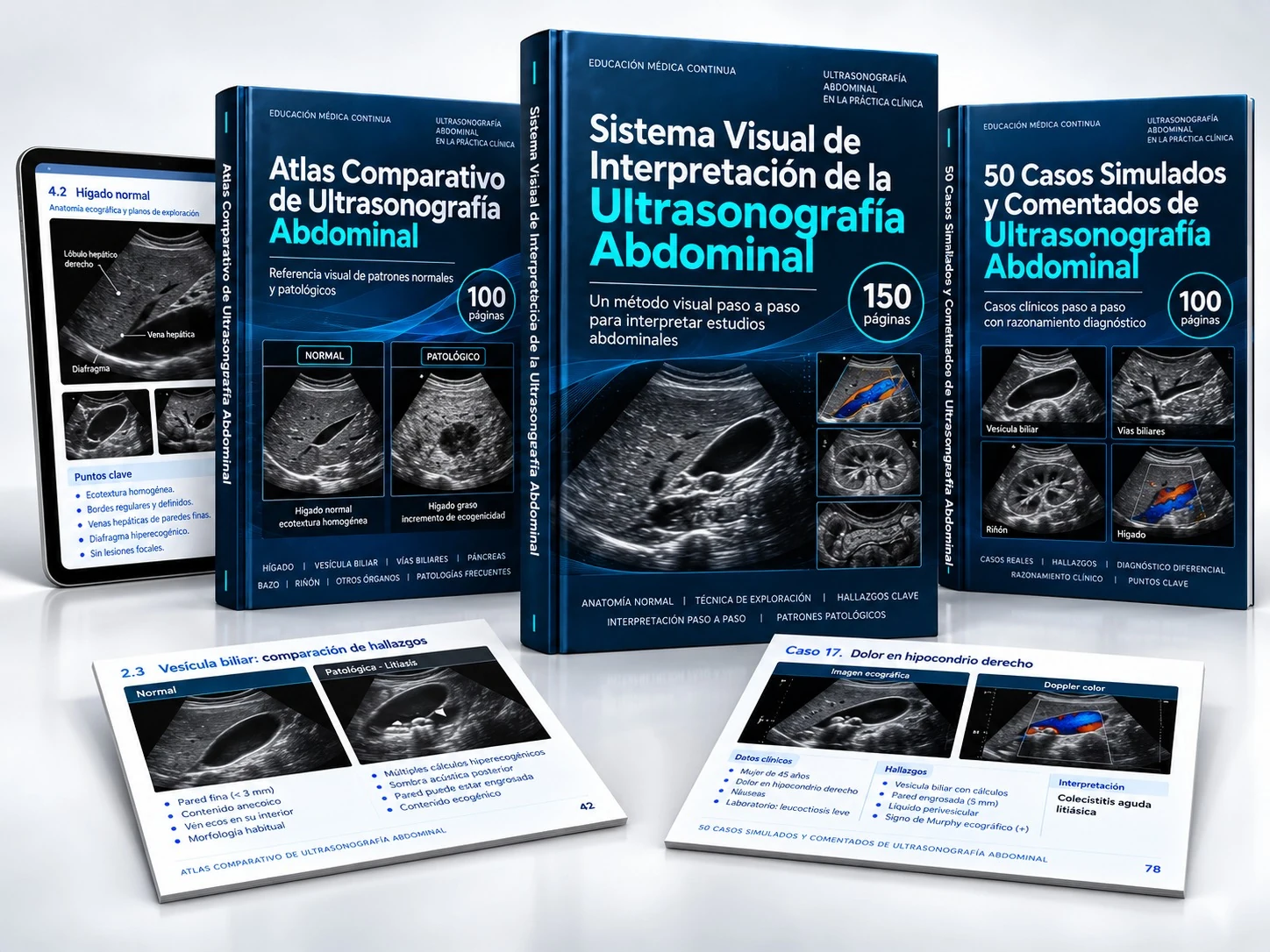 Composición ilustrativa de los tres recursos de ultrasonografía abdominal: Sistema Visual, Atlas Comparativo y 50 Casos Simulados